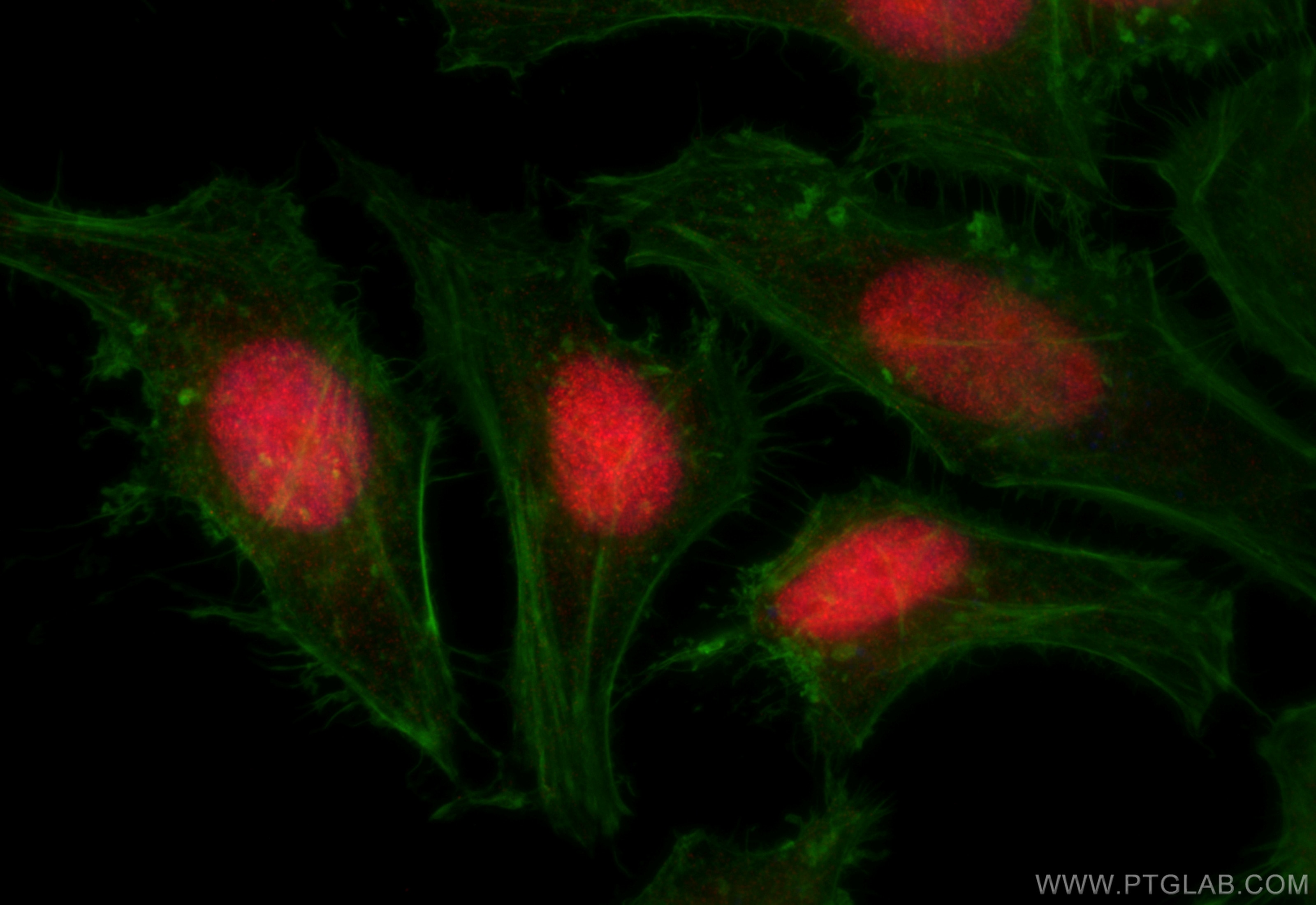 Immunofluorescence (IF) / fluorescent staining of HeLa cells using RPP25 Polyclonal antibody (15461-1-AP)