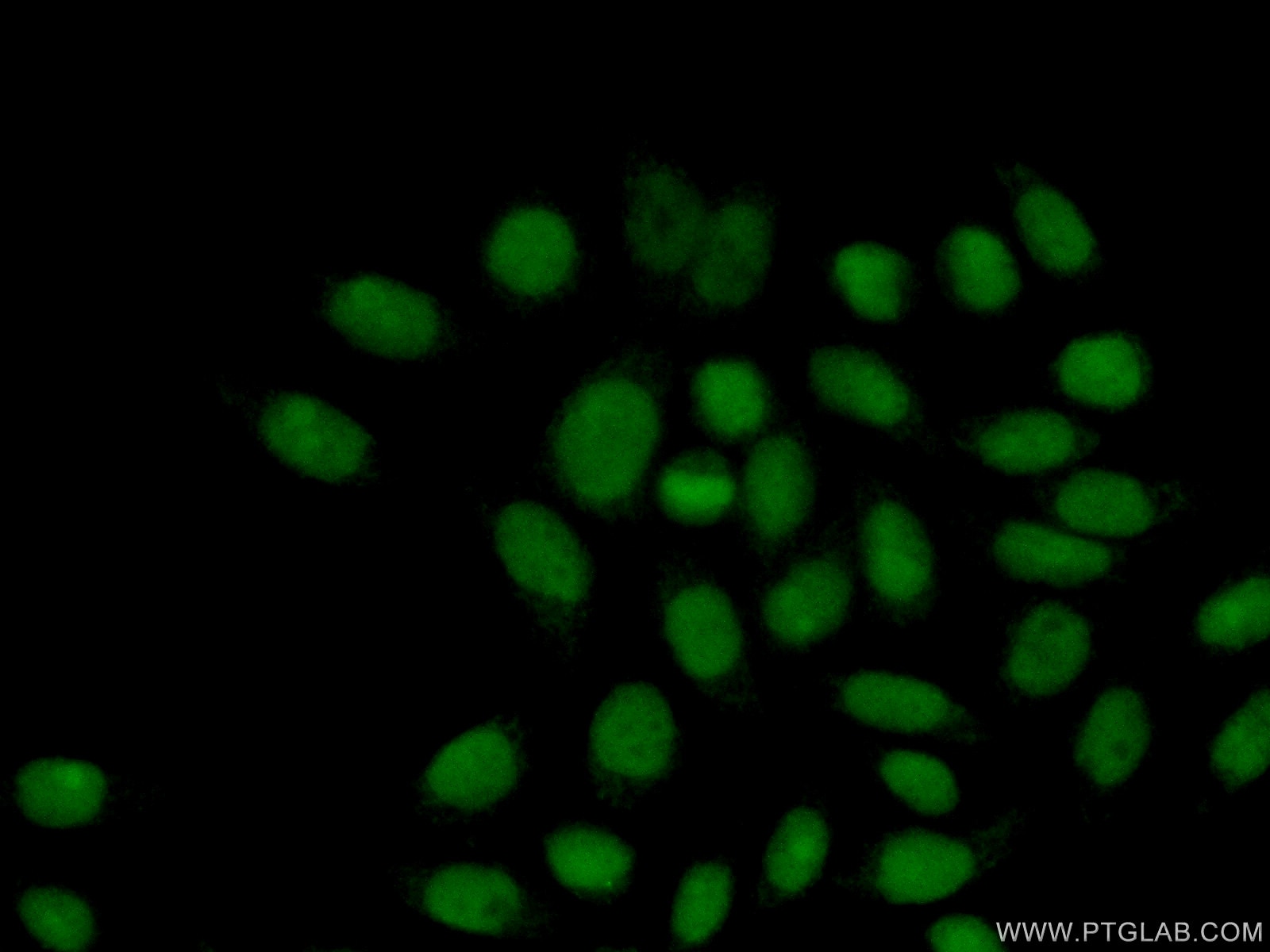 Immunofluorescence (IF) / fluorescent staining of HeLa cells using RPP25 Polyclonal antibody (15461-1-AP)