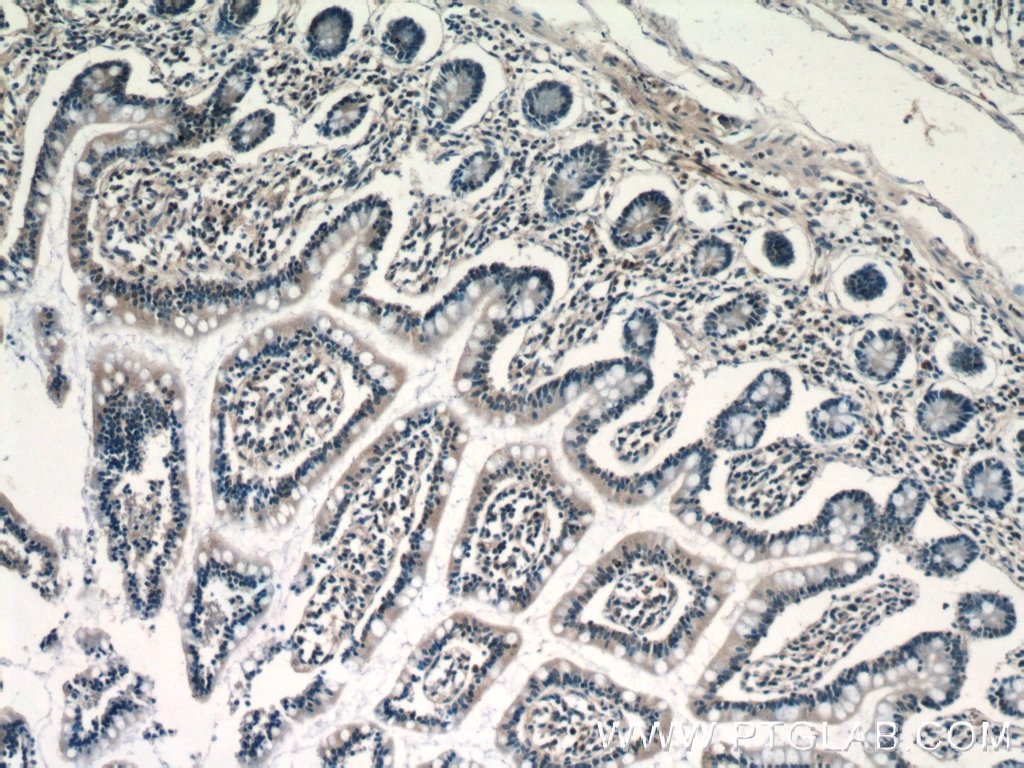 Immunohistochemistry (IHC) staining of human small intestine tissue using RPP25 Polyclonal antibody (15461-1-AP)