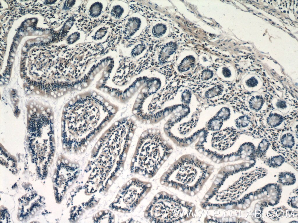 IHC staining of human small intestine using 15461-1-AP