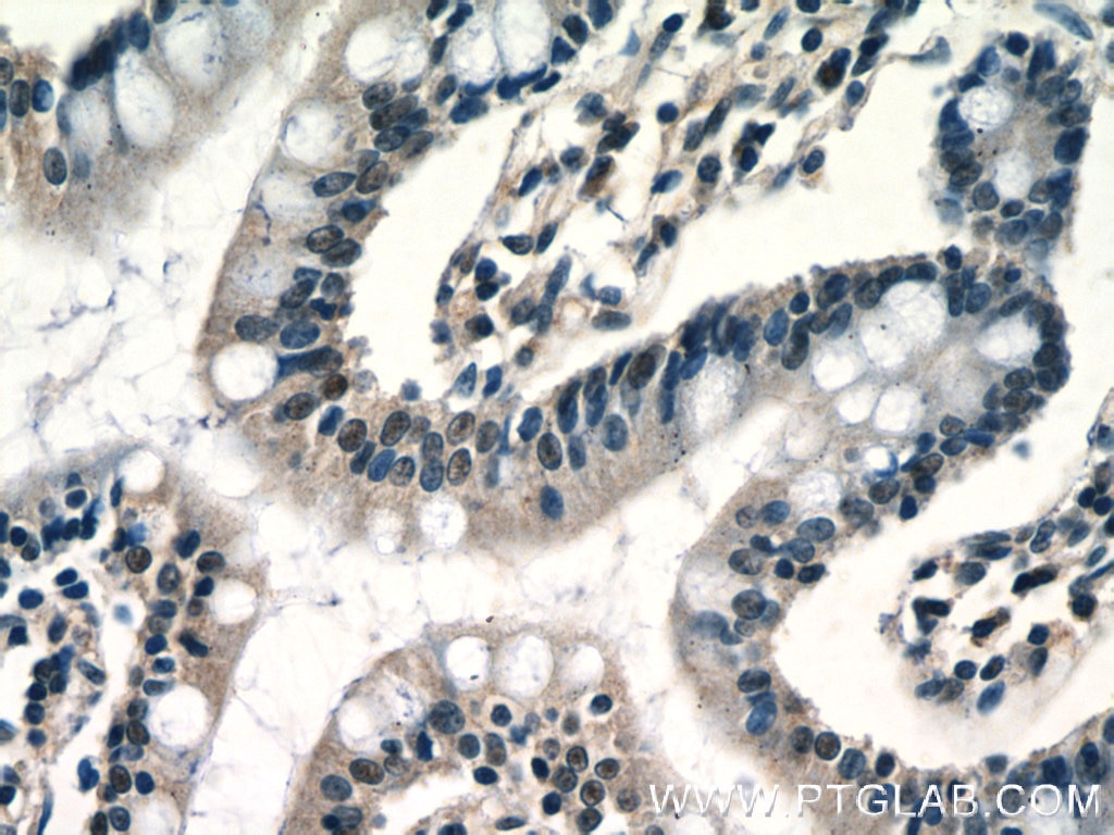 Immunohistochemistry (IHC) staining of human small intestine tissue using RPP25 Polyclonal antibody (15461-1-AP)