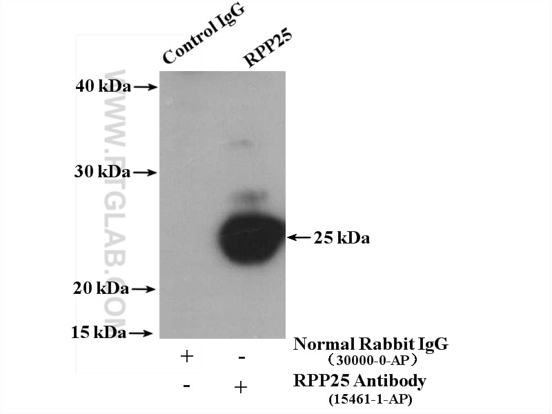 Immunoprecipitation (IP) experiment of HeLa cells using RPP25 Polyclonal antibody (15461-1-AP)