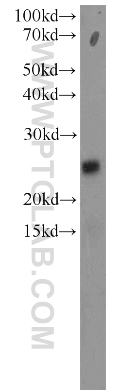 Western Blot (WB) analysis of HeLa cells using RPP25 Polyclonal antibody (15461-1-AP)