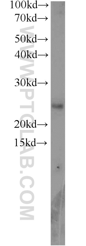 Western Blot (WB) analysis of MCF-7 cells using RPP25 Polyclonal antibody (15461-1-AP)