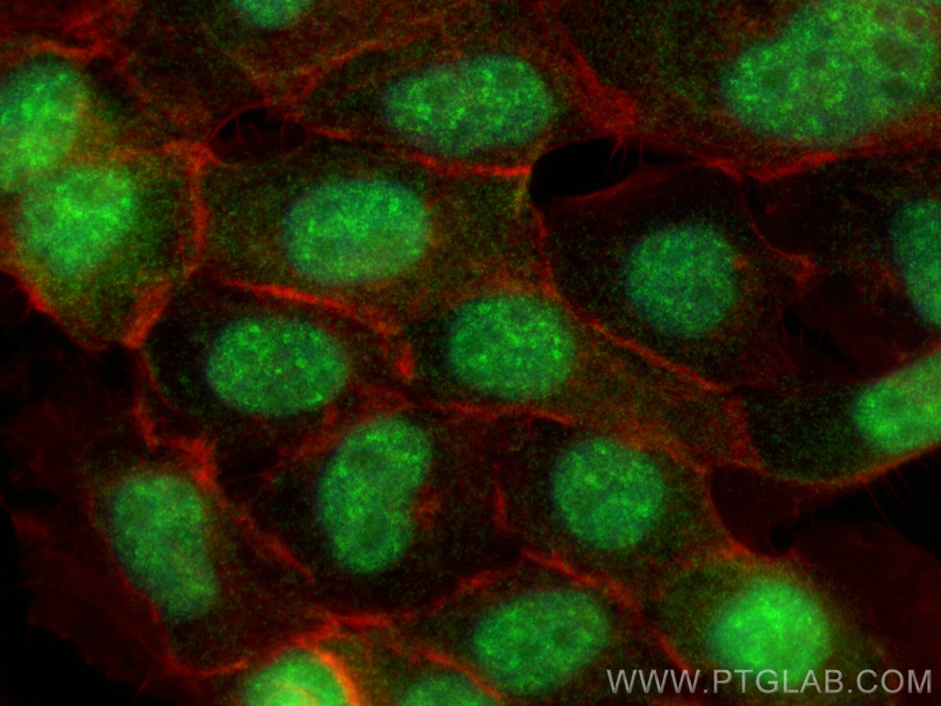 Immunofluorescence (IF) / fluorescent staining of U-251 cells using RPP30 Polyclonal antibody (18435-1-AP)