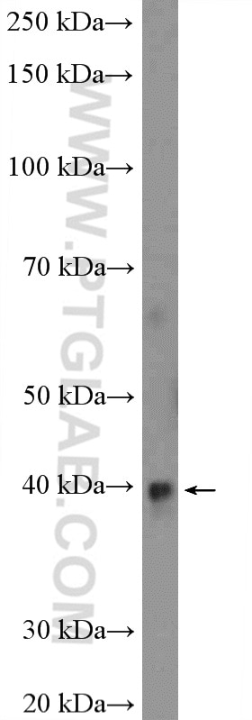 Western Blot (WB) analysis of rat kidney tissue using RPP38 Polyclonal antibody (12874-1-AP)