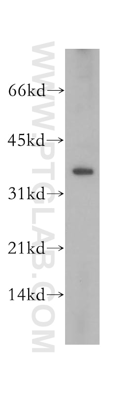 Western Blot (WB) analysis of HeLa cells using RPP38 Polyclonal antibody (12874-1-AP)