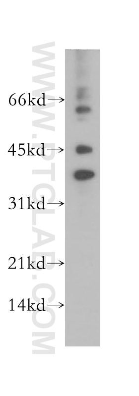Western Blot (WB) analysis of human kidney tissue using RPP38 Polyclonal antibody (12874-1-AP)