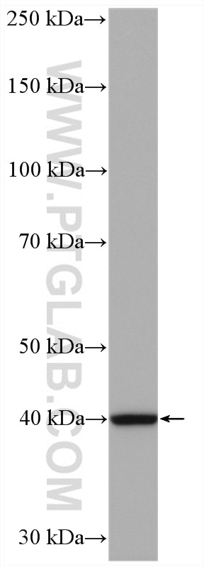 Western Blot (WB) analysis of HeLa cells using RPP40 Polyclonal antibody (11736-1-AP)