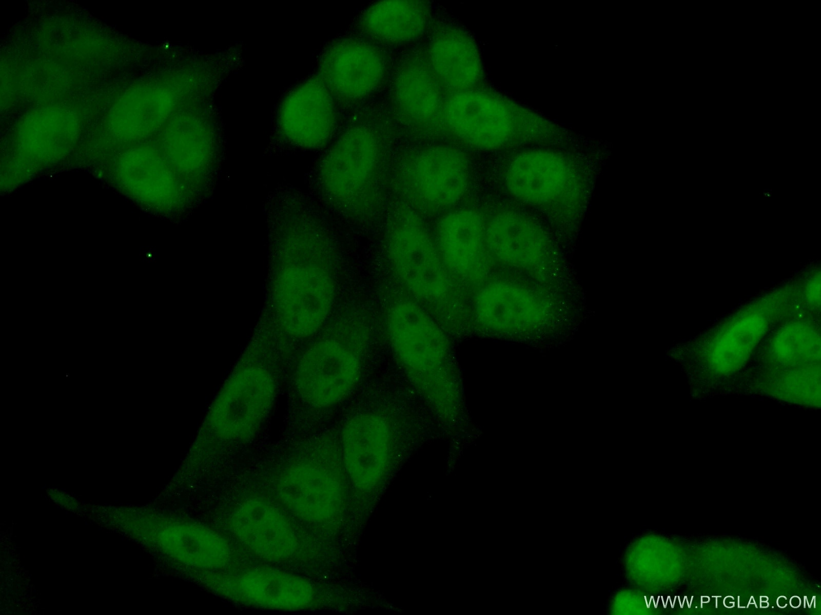 Immunofluorescence (IF) / fluorescent staining of HeLa cells using RPRD1B Polyclonal antibody (24542-1-AP)