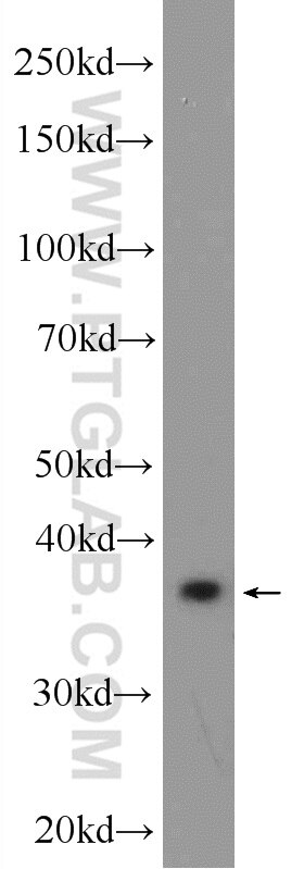 Western Blot (WB) analysis of Jurkat cells using RPRD1B Polyclonal antibody (24542-1-AP)