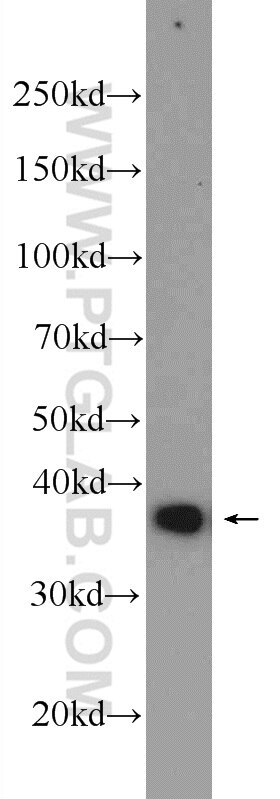 Western Blot (WB) analysis of HeLa cells using RPRD1B Polyclonal antibody (24542-1-AP)