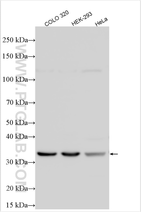 Western Blot (WB) analysis of various lysates using RPRD1B Polyclonal antibody (24542-1-AP)