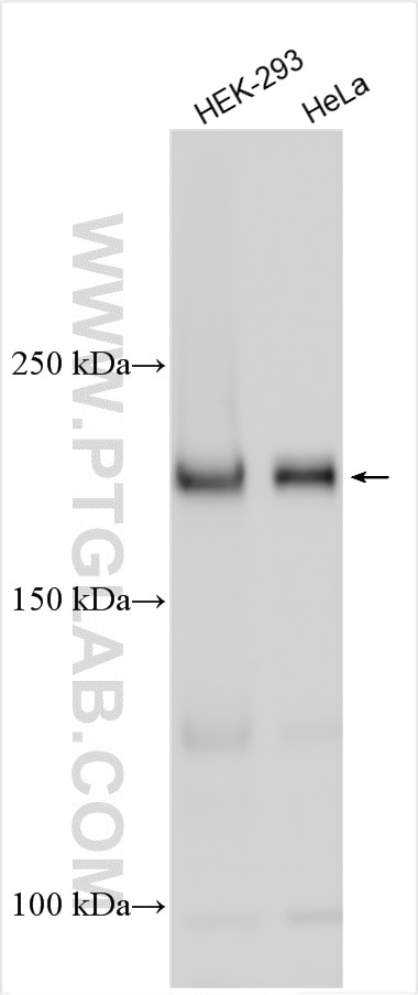 Western Blot (WB) analysis of various lysates using RPRD2 Polyclonal antibody (33037-1-AP)