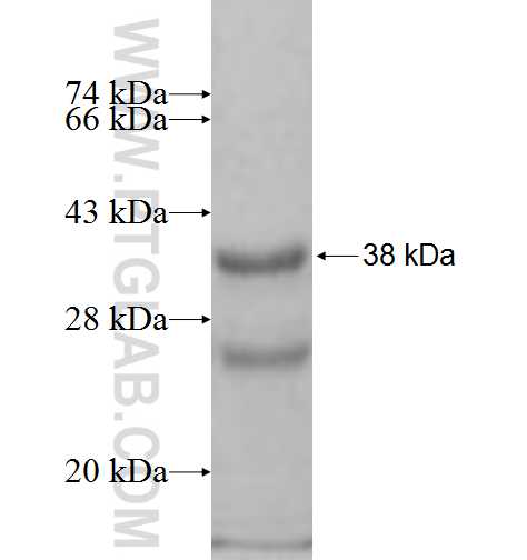 RPRM fusion protein Ag7548 SDS-PAGE