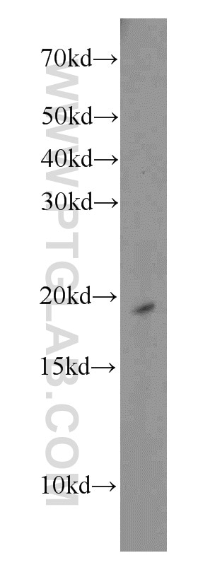 Western Blot (WB) analysis of Raji cells using RPS10 Polyclonal antibody (14894-1-AP)