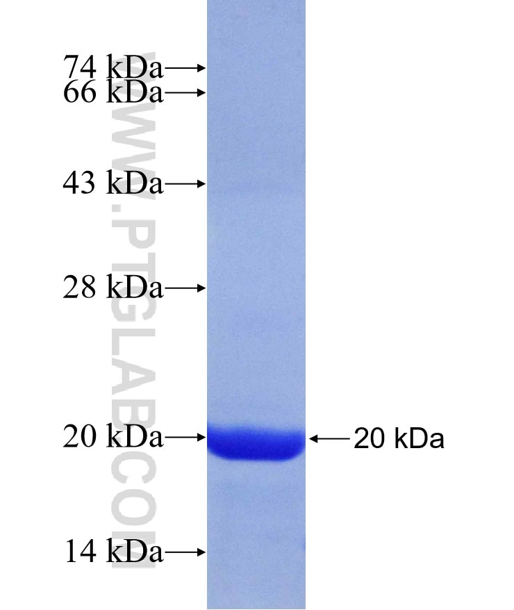 RPS10 fusion protein Ag7018 SDS-PAGE