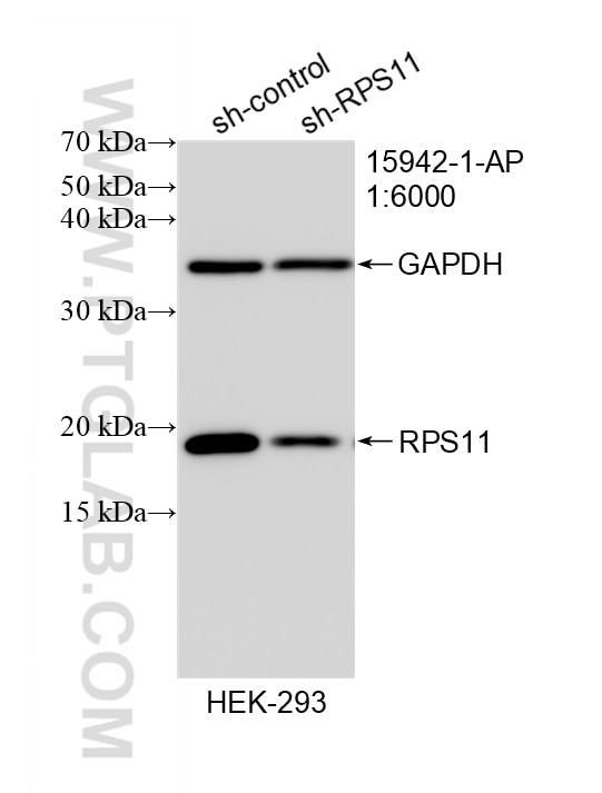 Western Blot (WB) analysis of HEK-293 cells using RPS11 Polyclonal antibody (15942-1-AP)