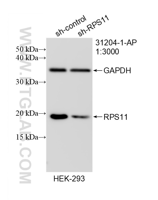 Western Blot (WB) analysis of HEK-293 cells using RPS11 Polyclonal antibody (31204-1-AP)