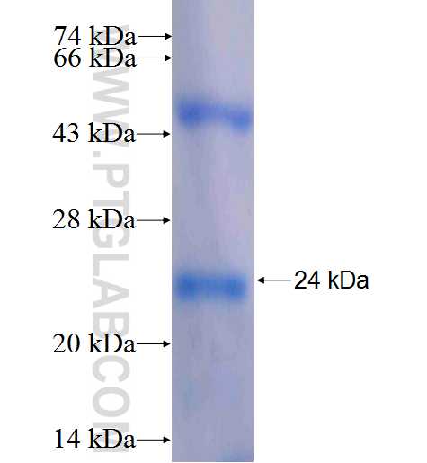 RPS11 fusion protein Ag8361 SDS-PAGE