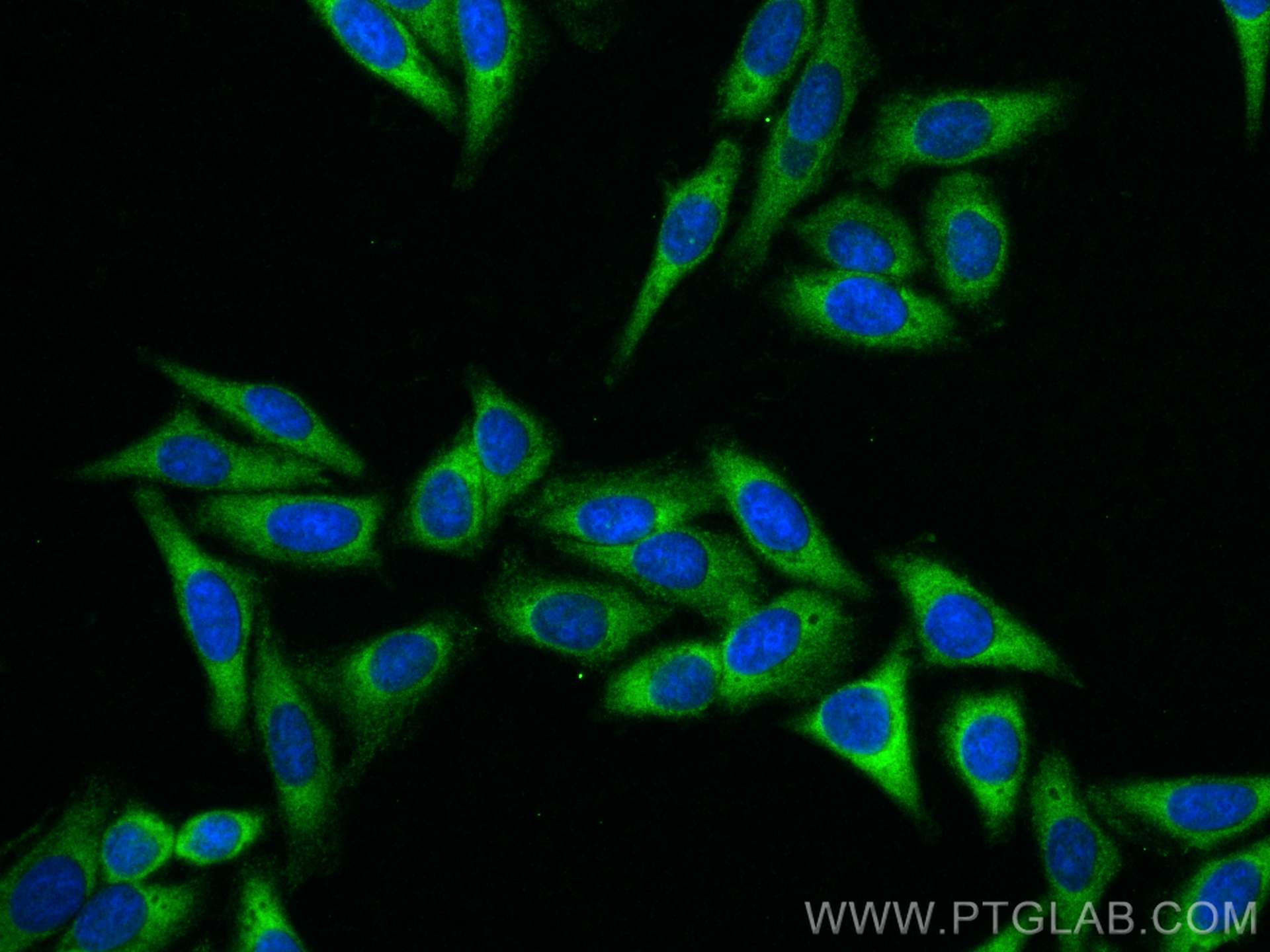 Immunofluorescence (IF) / fluorescent staining of HepG2 cells using RPS12 Polyclonal antibody (16490-1-AP)