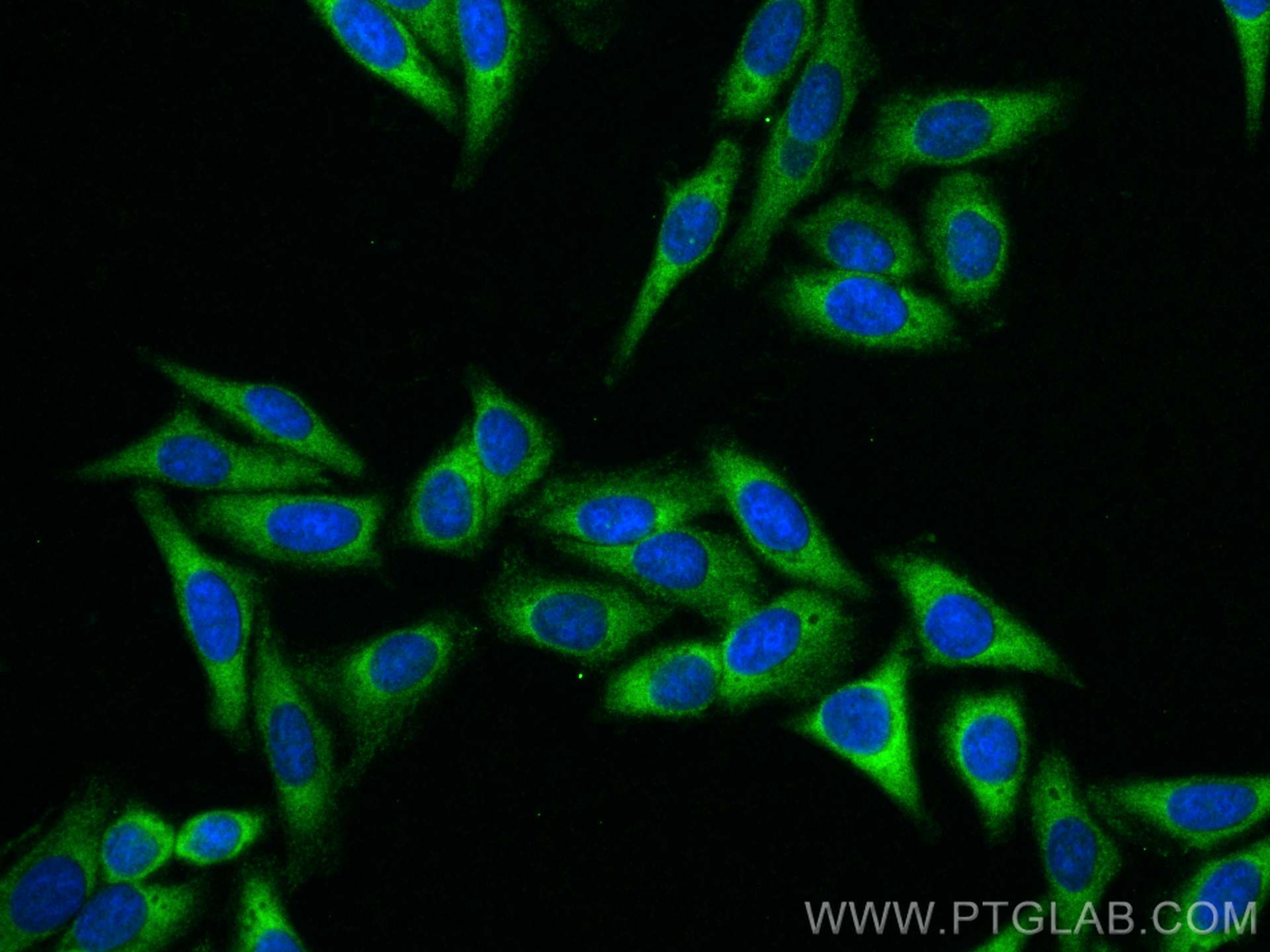 IF Staining of HepG2 using 16490-1-AP