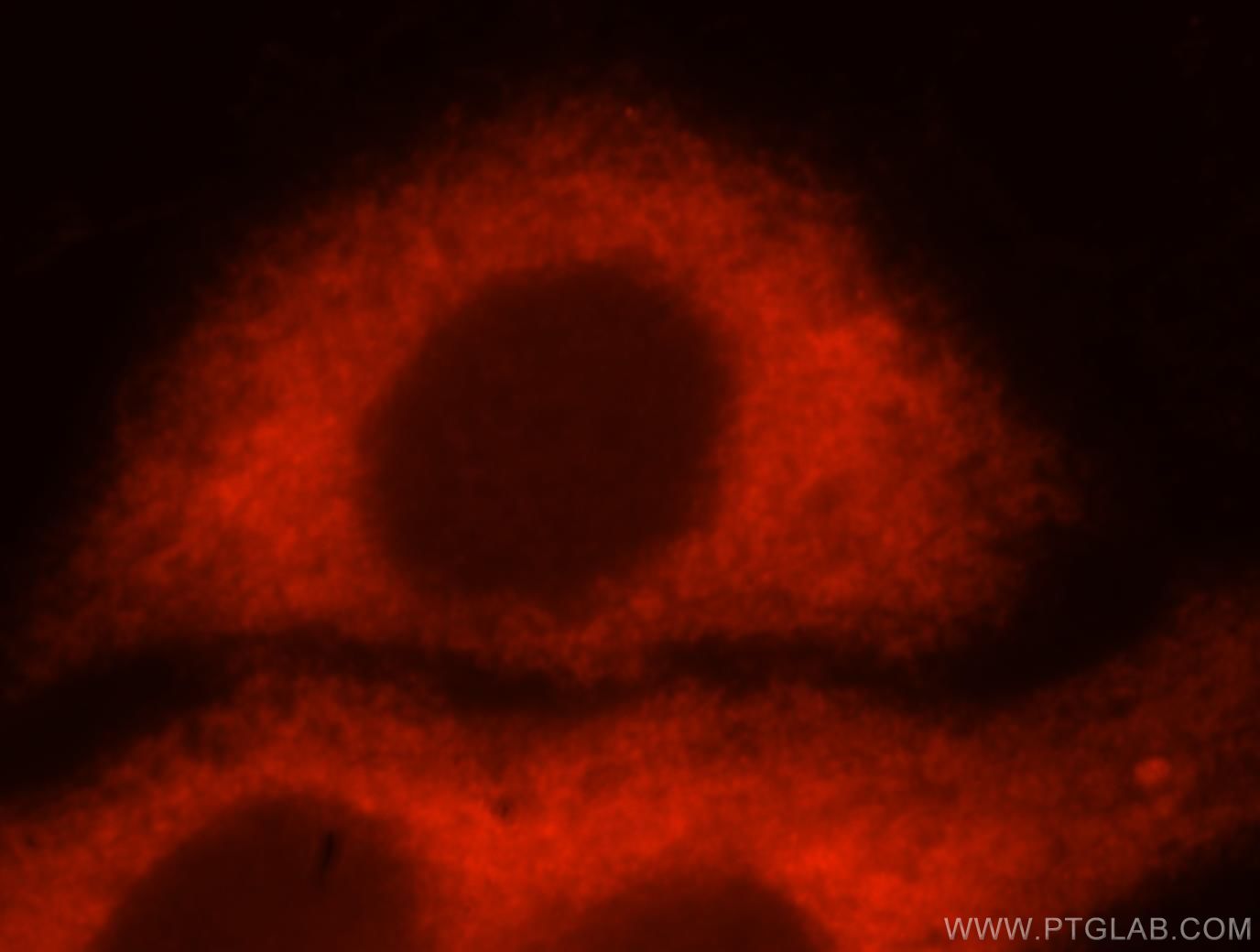 Immunofluorescence (IF) / fluorescent staining of HepG2 cells using RPS12 Polyclonal antibody (16490-1-AP)
