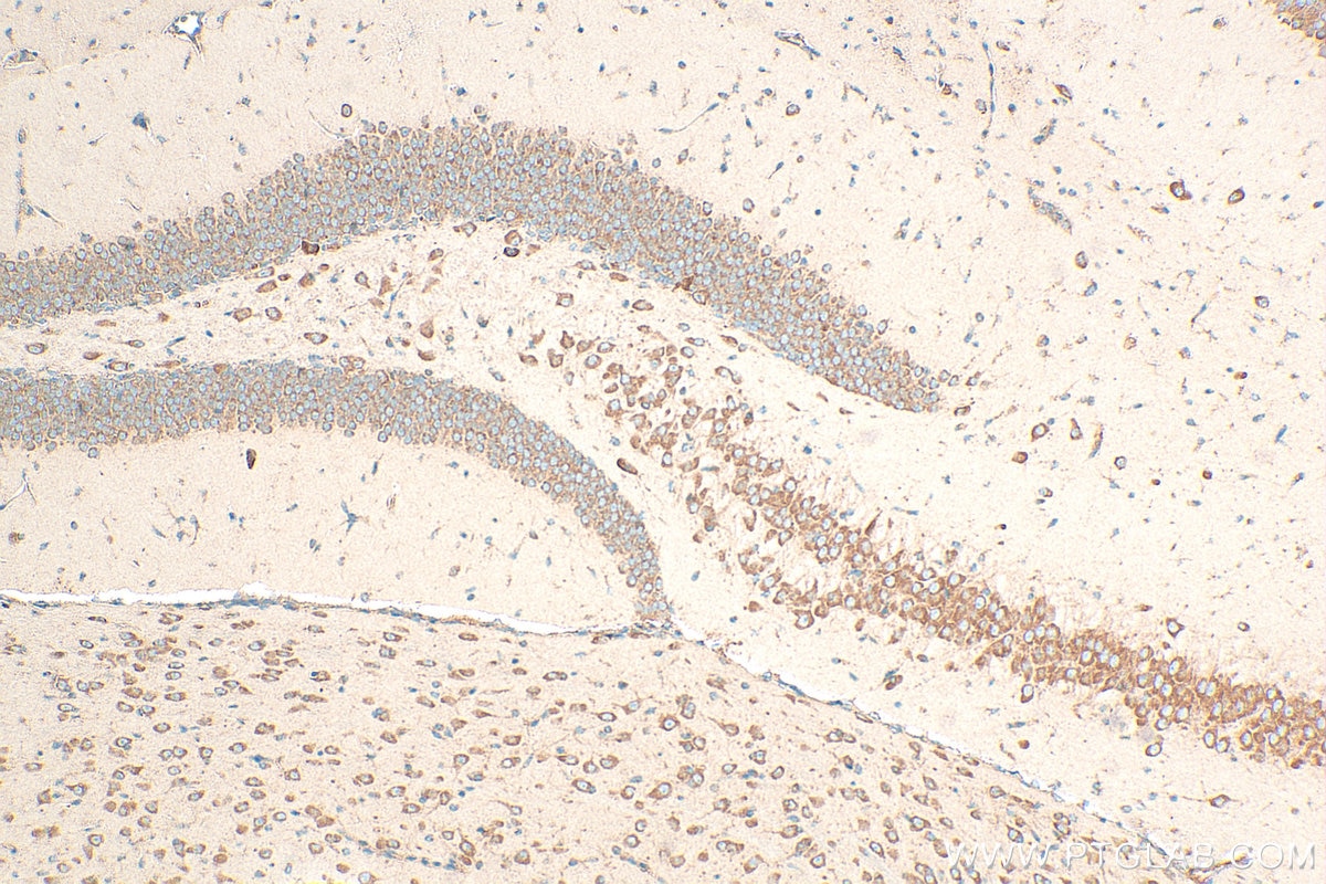 Immunohistochemistry (IHC) staining of mouse brain tissue using RPS12 Polyclonal antibody (16490-1-AP)
