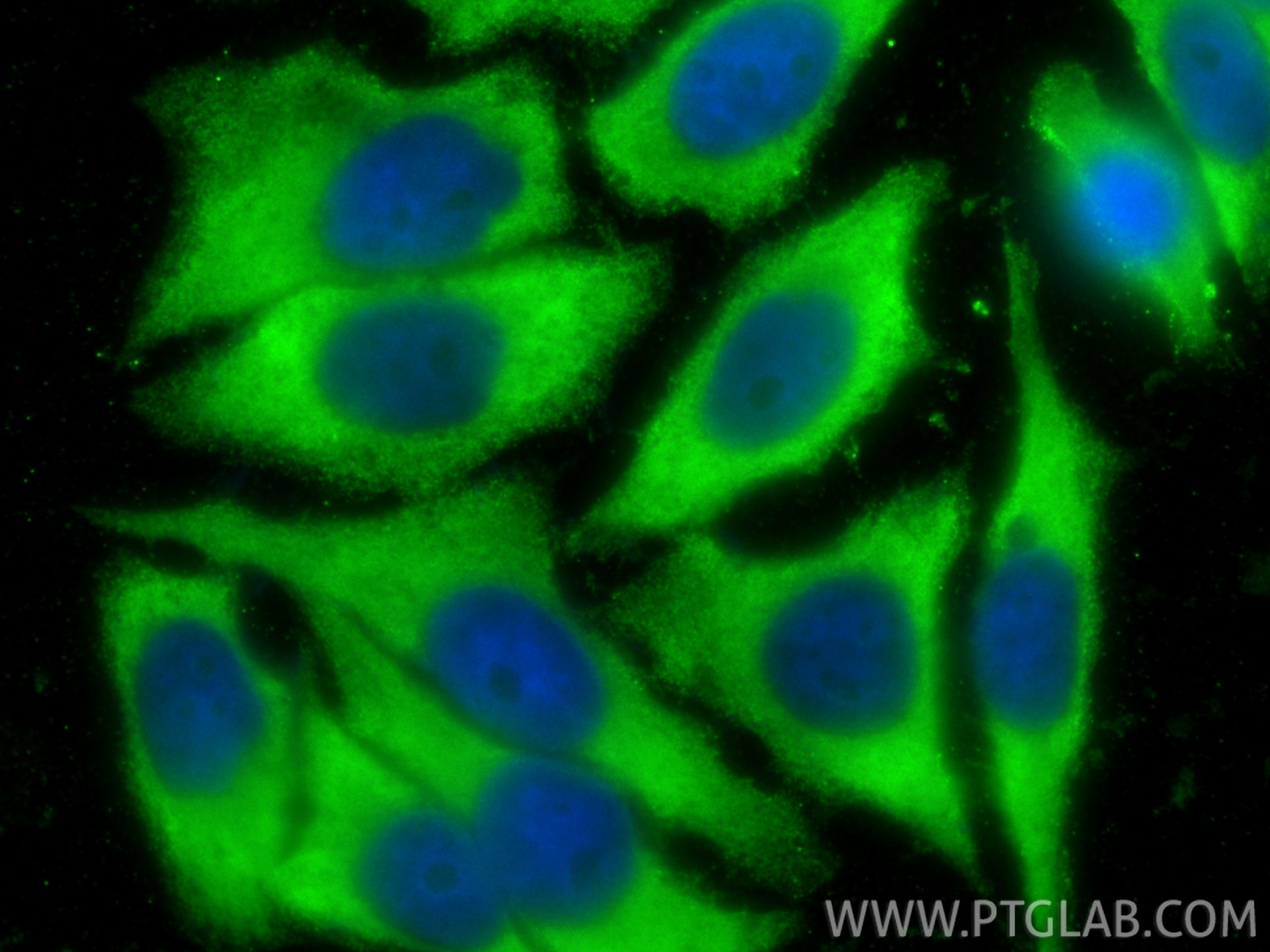 Immunofluorescence (IF) / fluorescent staining of HepG2 cells using RPS12 Monoclonal antibody (67683-1-Ig)