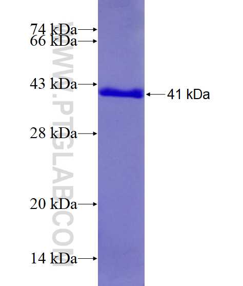 RPS12 fusion protein Ag9615 SDS-PAGE