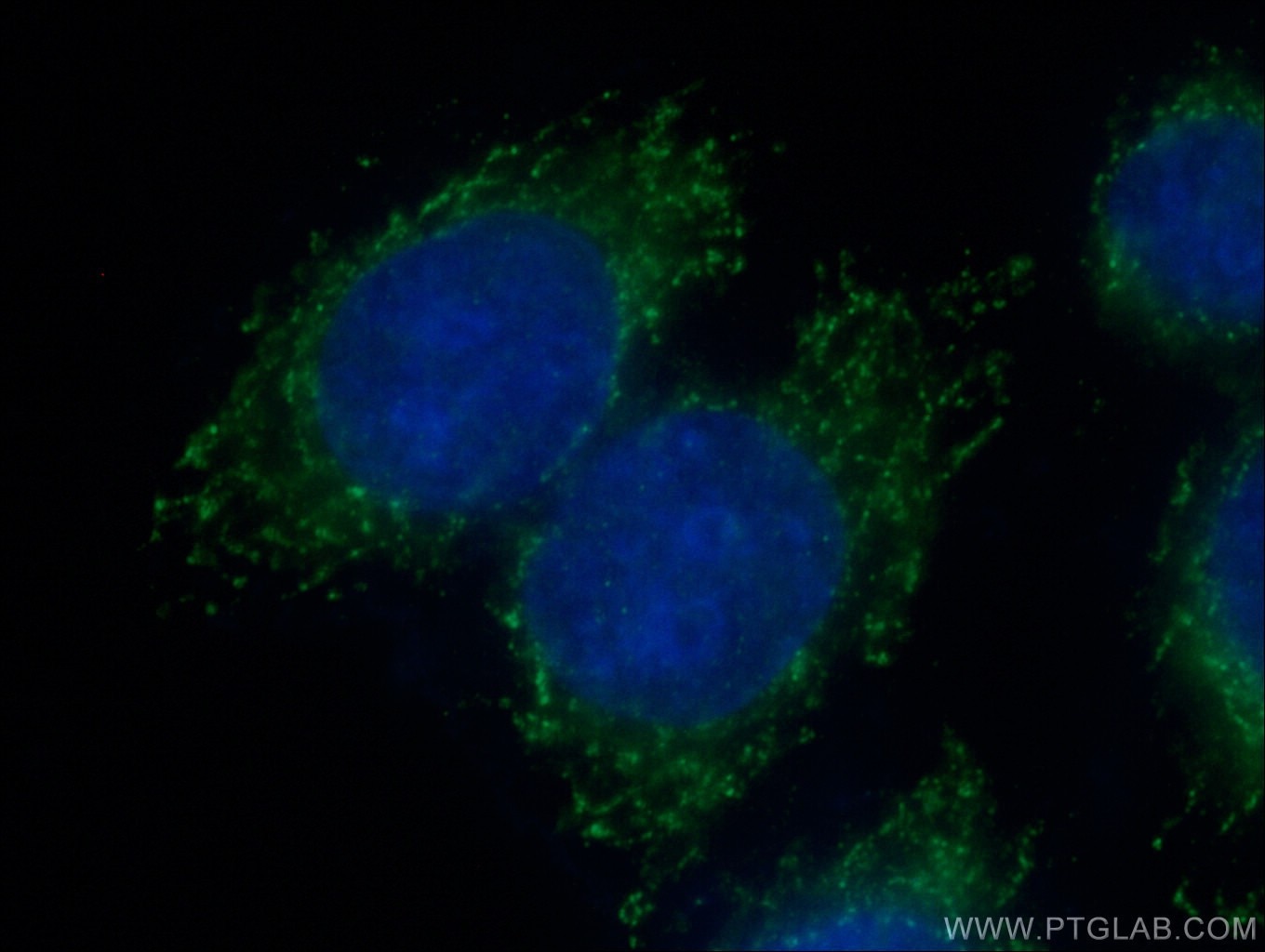 Immunofluorescence (IF) / fluorescent staining of HeLa cells using RPS13 Polyclonal antibody (16680-1-AP)