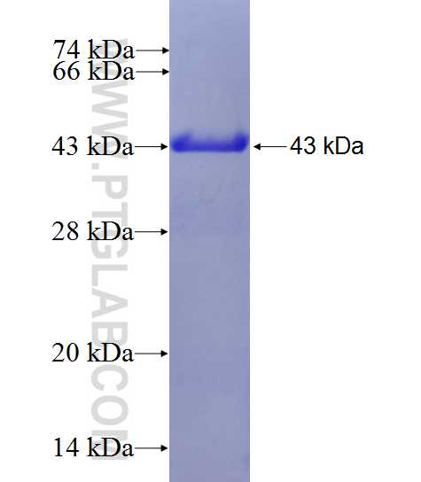 RPS13 fusion protein Ag10008 SDS-PAGE