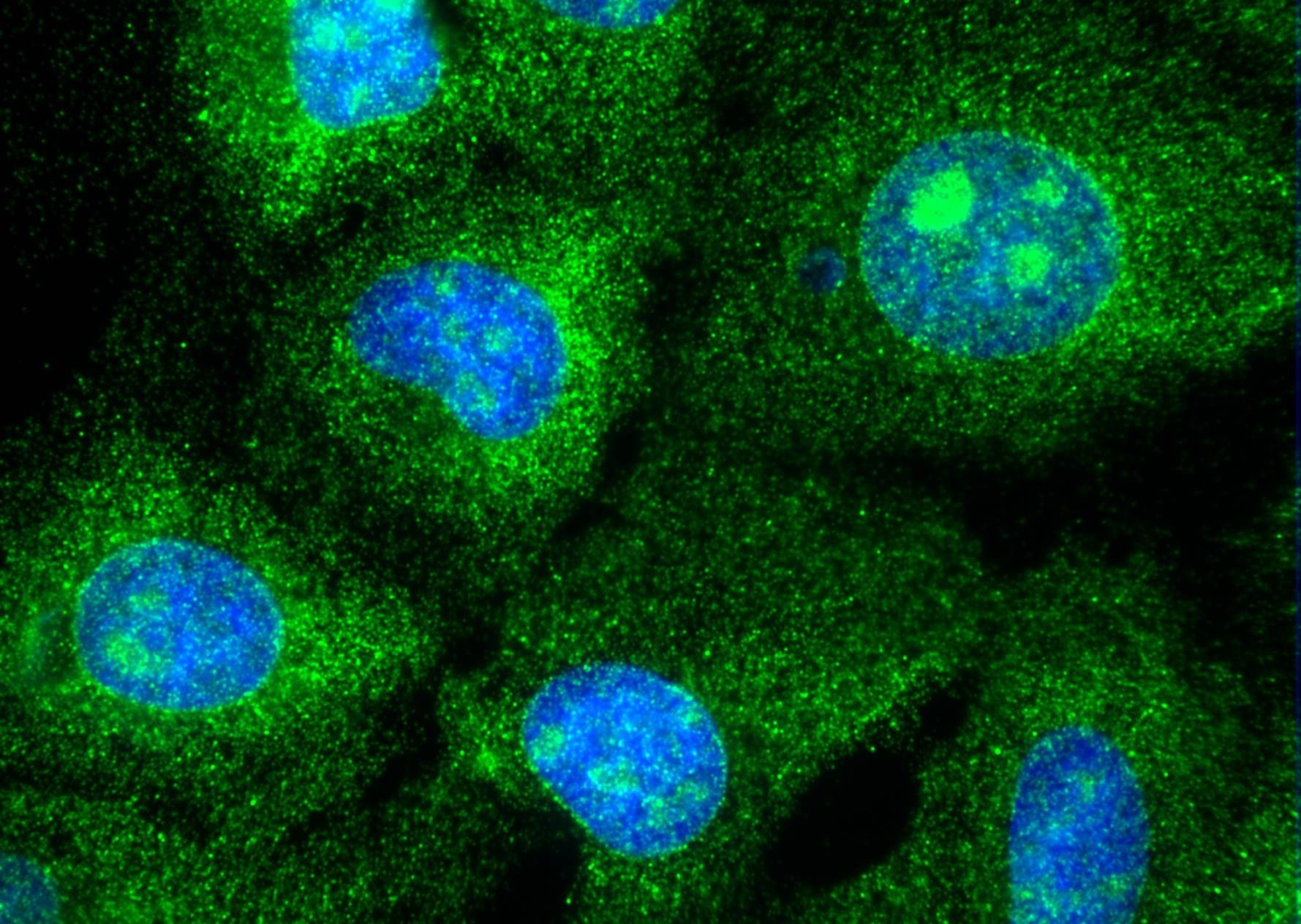 Immunofluorescence (IF) / fluorescent staining of U2OS cells using RPS14 Polyclonal antibody (16683-1-AP)