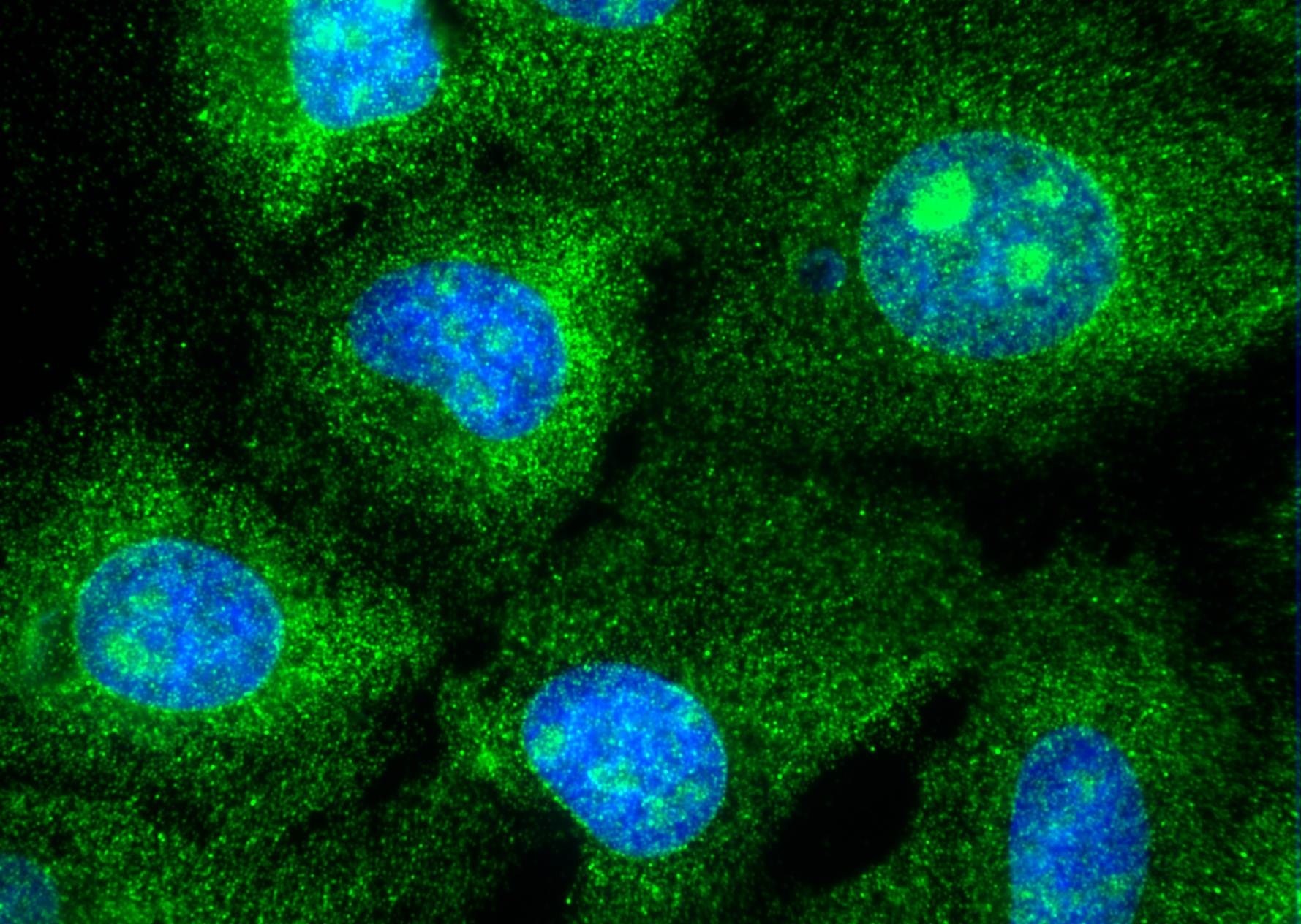 IF Staining of U2OS cells using 16683-1-AP