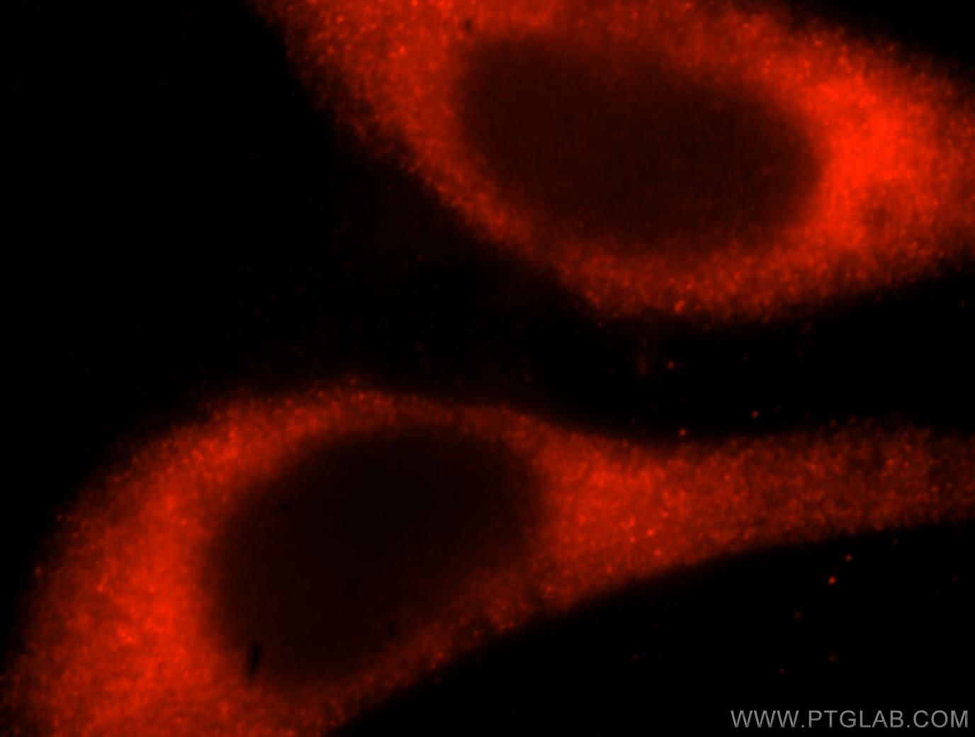 Immunofluorescence (IF) / fluorescent staining of HepG2 cells using RPS14 Polyclonal antibody (16683-1-AP)