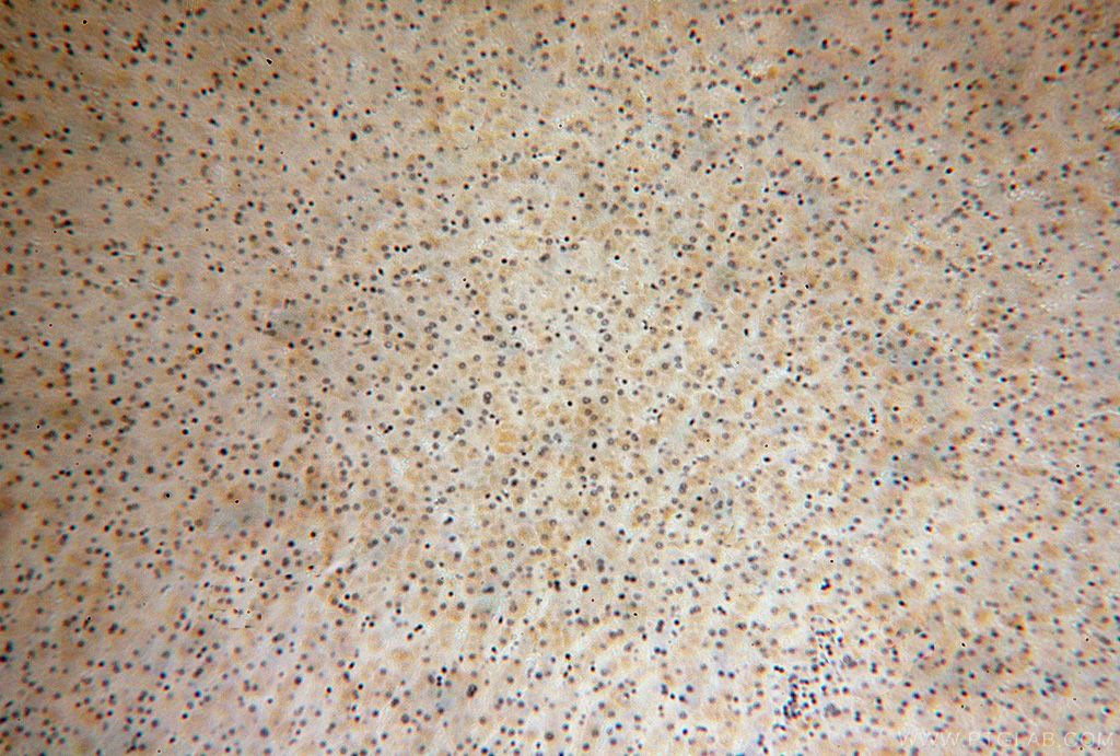 Immunohistochemistry (IHC) staining of human liver tissue using RPS14 Polyclonal antibody (16683-1-AP)