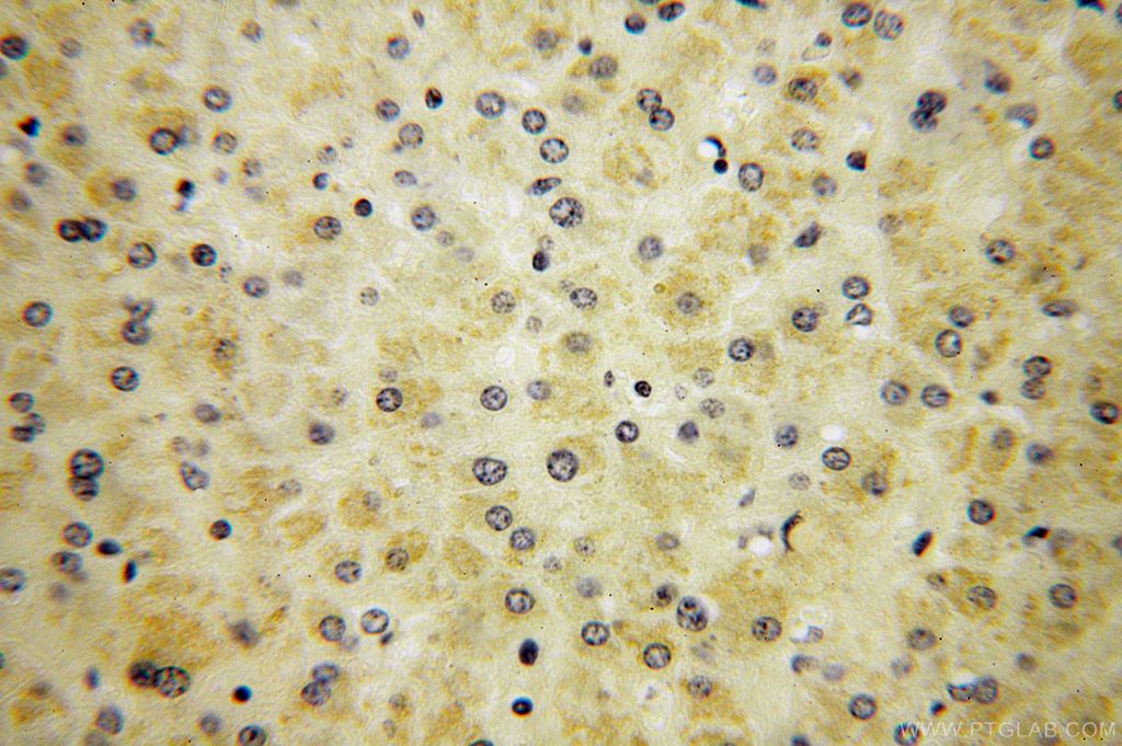 Immunohistochemistry (IHC) staining of human liver tissue using RPS14 Polyclonal antibody (16683-1-AP)