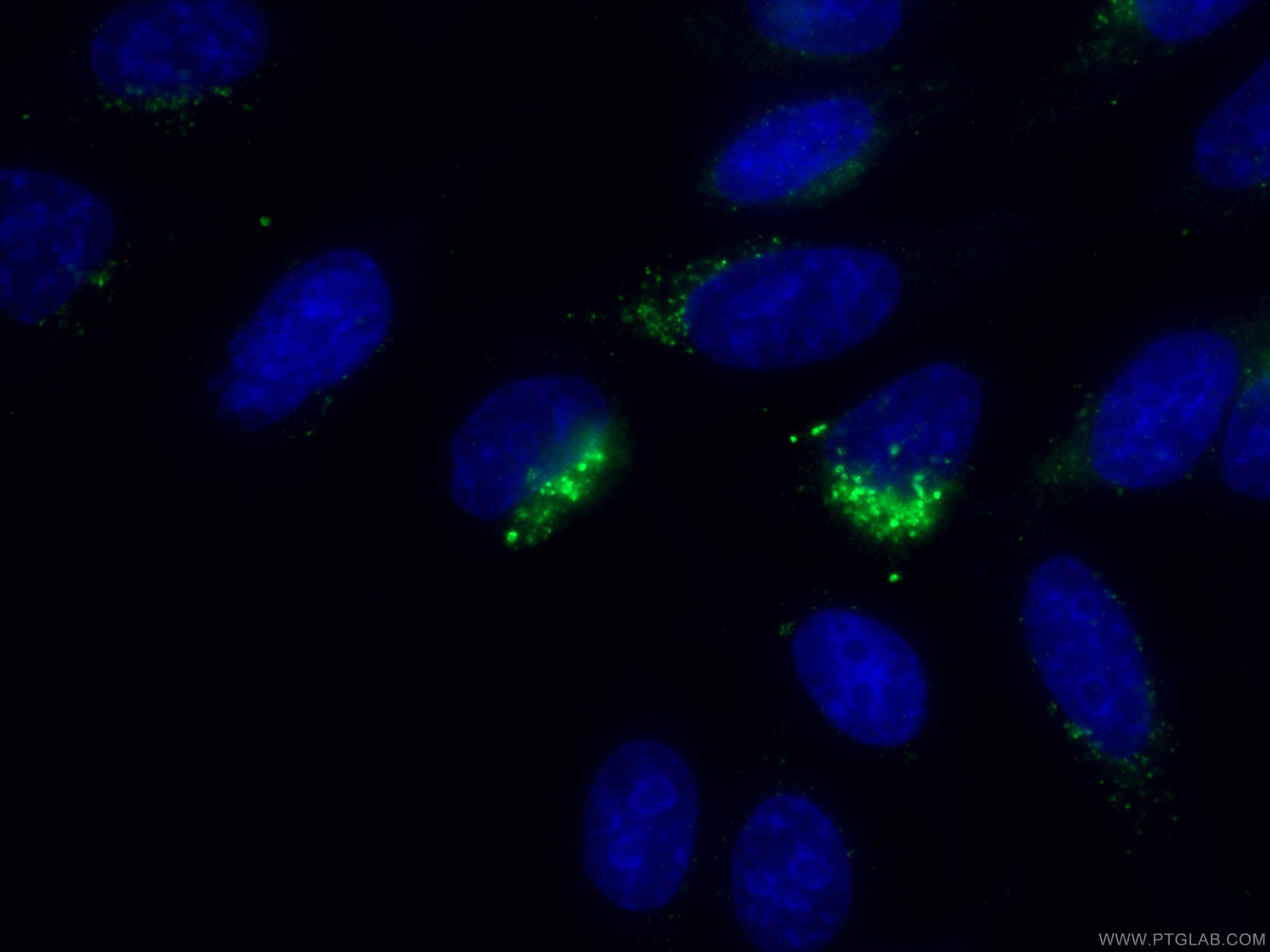Immunofluorescence (IF) / fluorescent staining of HepG2 cells using RPS14 Monoclonal antibody (67566-1-Ig)