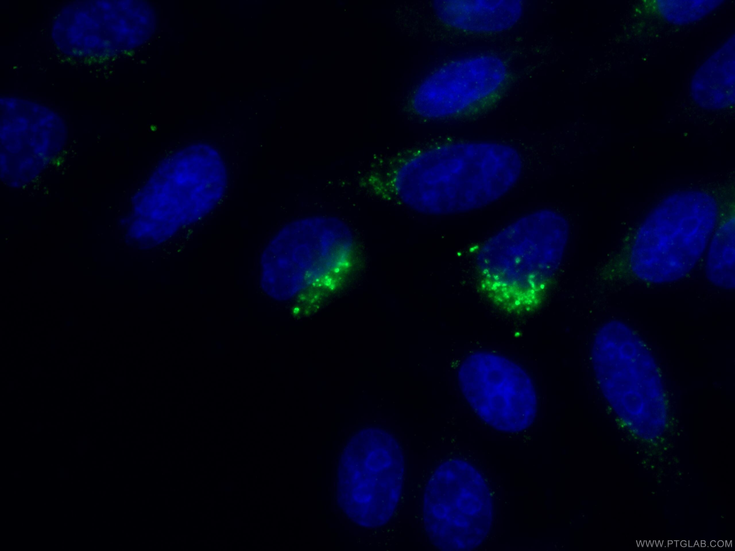 Immunofluorescence (IF) / fluorescent staining of HepG2 cells using RPS14 Monoclonal antibody (67566-1-Ig)