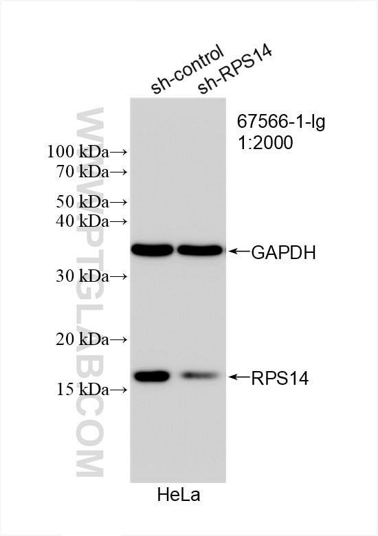 Western Blot (WB) analysis of HeLa cells using RPS14 Monoclonal antibody (67566-1-Ig)