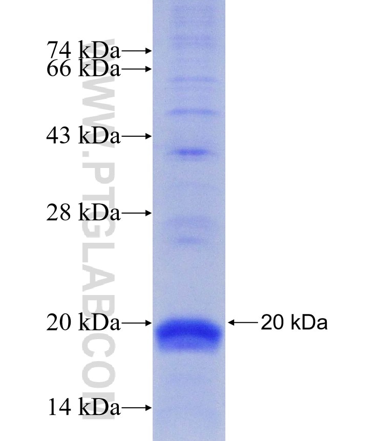 RPS14 fusion protein Ag30032 SDS-PAGE