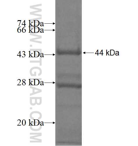 RPS14 fusion protein Ag10012 SDS-PAGE