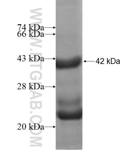 RPS14 fusion protein Ag9987 SDS-PAGE