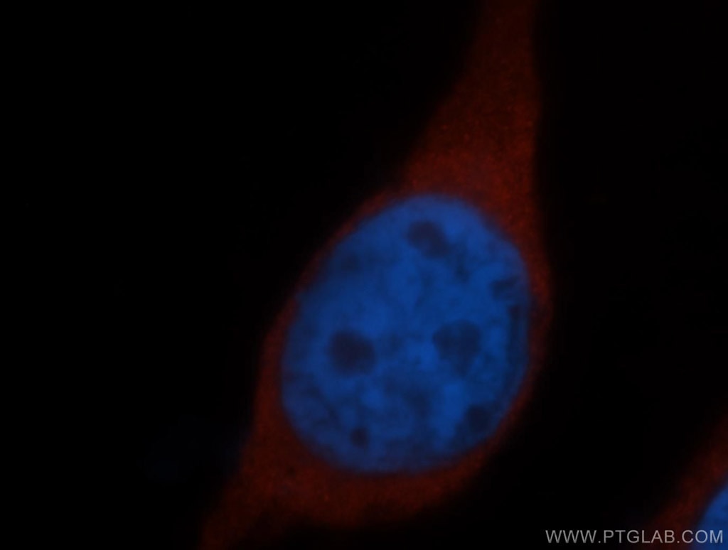 Immunofluorescence (IF) / fluorescent staining of HeLa cells using RPS15 Polyclonal antibody (14957-1-AP)