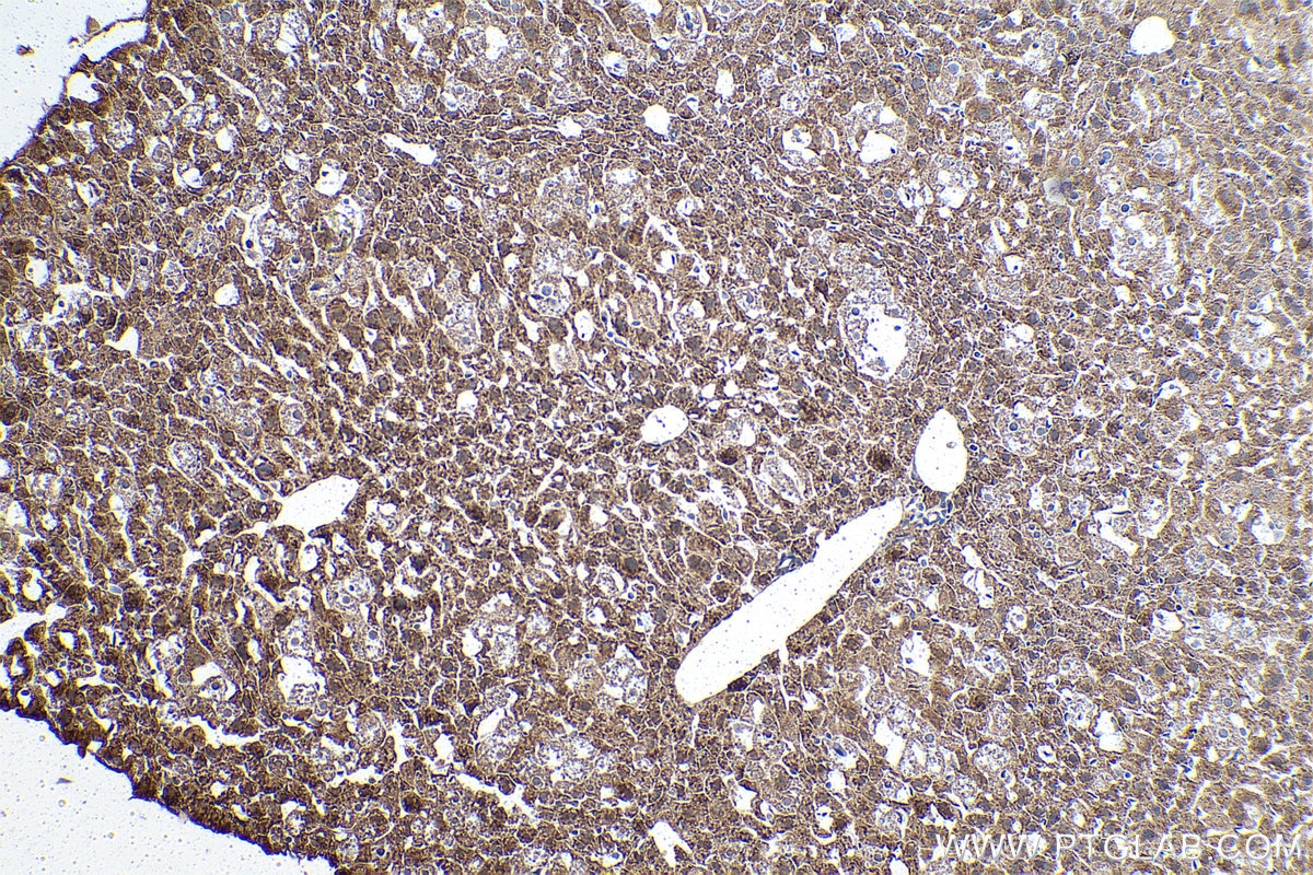 Immunohistochemistry (IHC) staining of mouse liver tissue using RPS15 Polyclonal antibody (14957-1-AP)