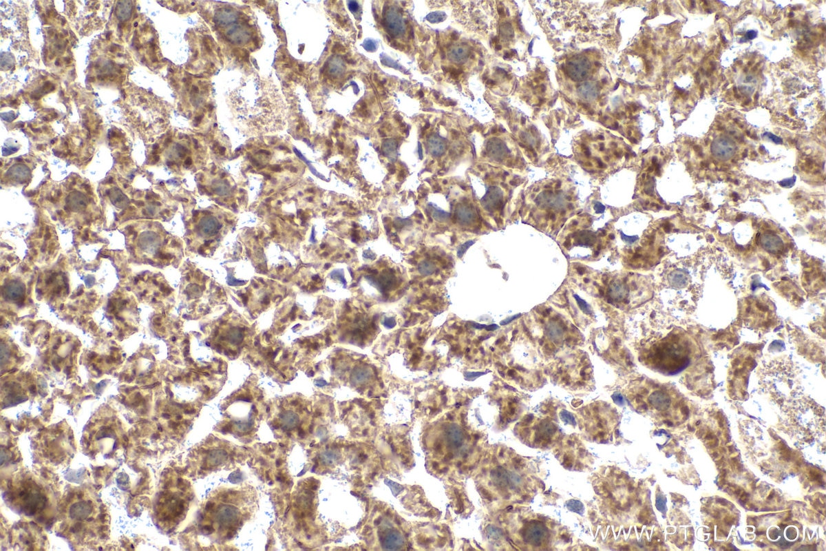 Immunohistochemistry (IHC) staining of mouse liver tissue using RPS15 Polyclonal antibody (14957-1-AP)