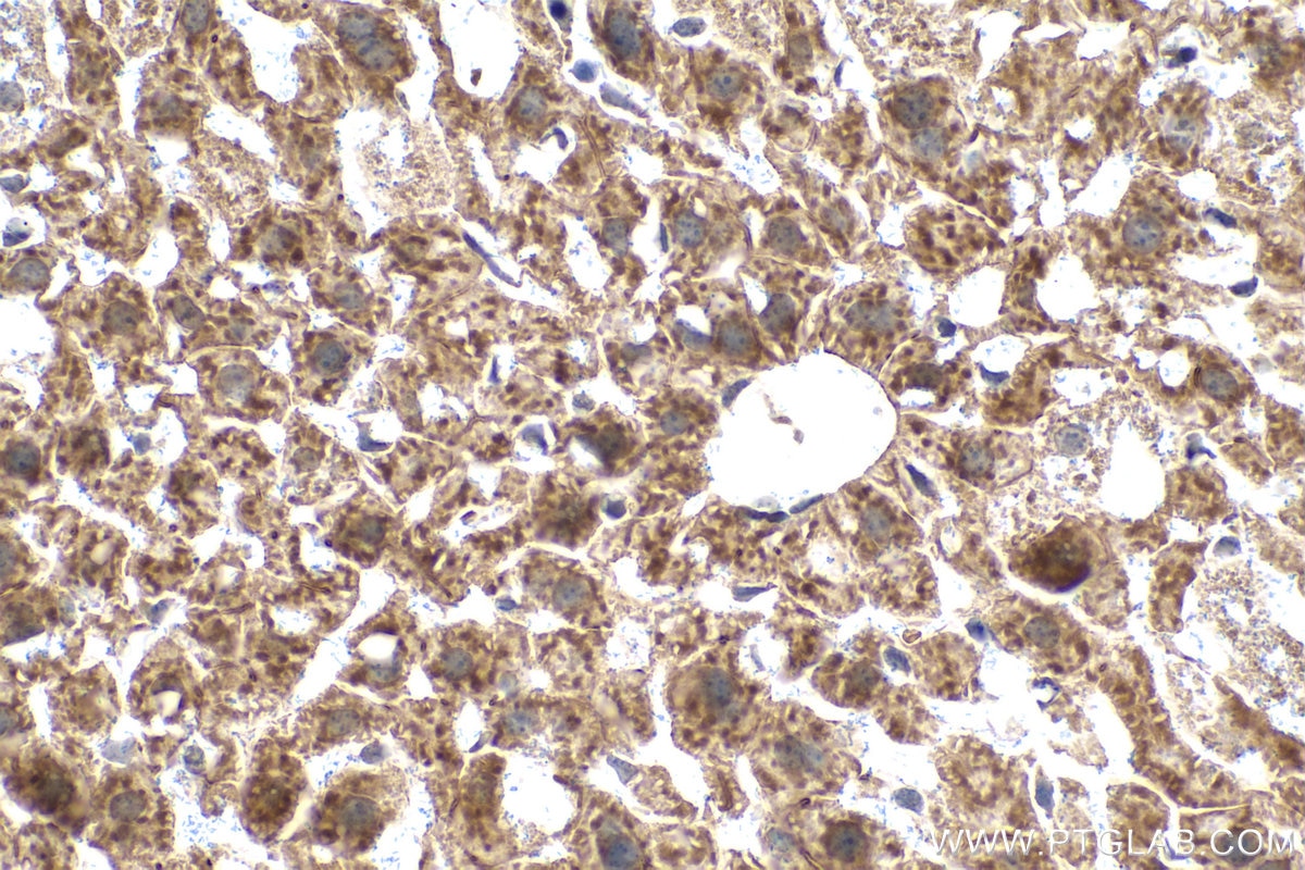 IHC staining of mouse liver using 14957-1-AP