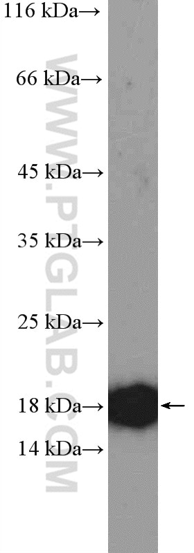 Western Blot (WB) analysis of HeLa cells using RPS15 Polyclonal antibody (14957-1-AP)