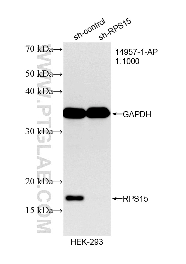 WB analysis of HEK-293 using 14957-1-AP Western Blot (WB) analysis of HEK-293 cells using RPS15 Polyclonal antibody (14957-1-AP)