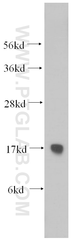 Western Blot (WB) analysis of human liver tissue using RPS15 Polyclonal antibody (14957-1-AP)